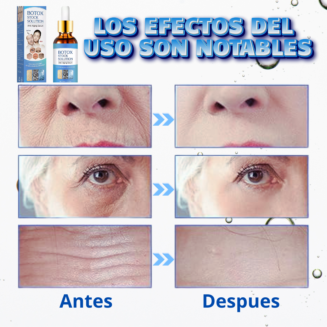 BOTOX SUERO ANTIEDAD