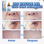 BOTOX SUERO ANTIEDAD