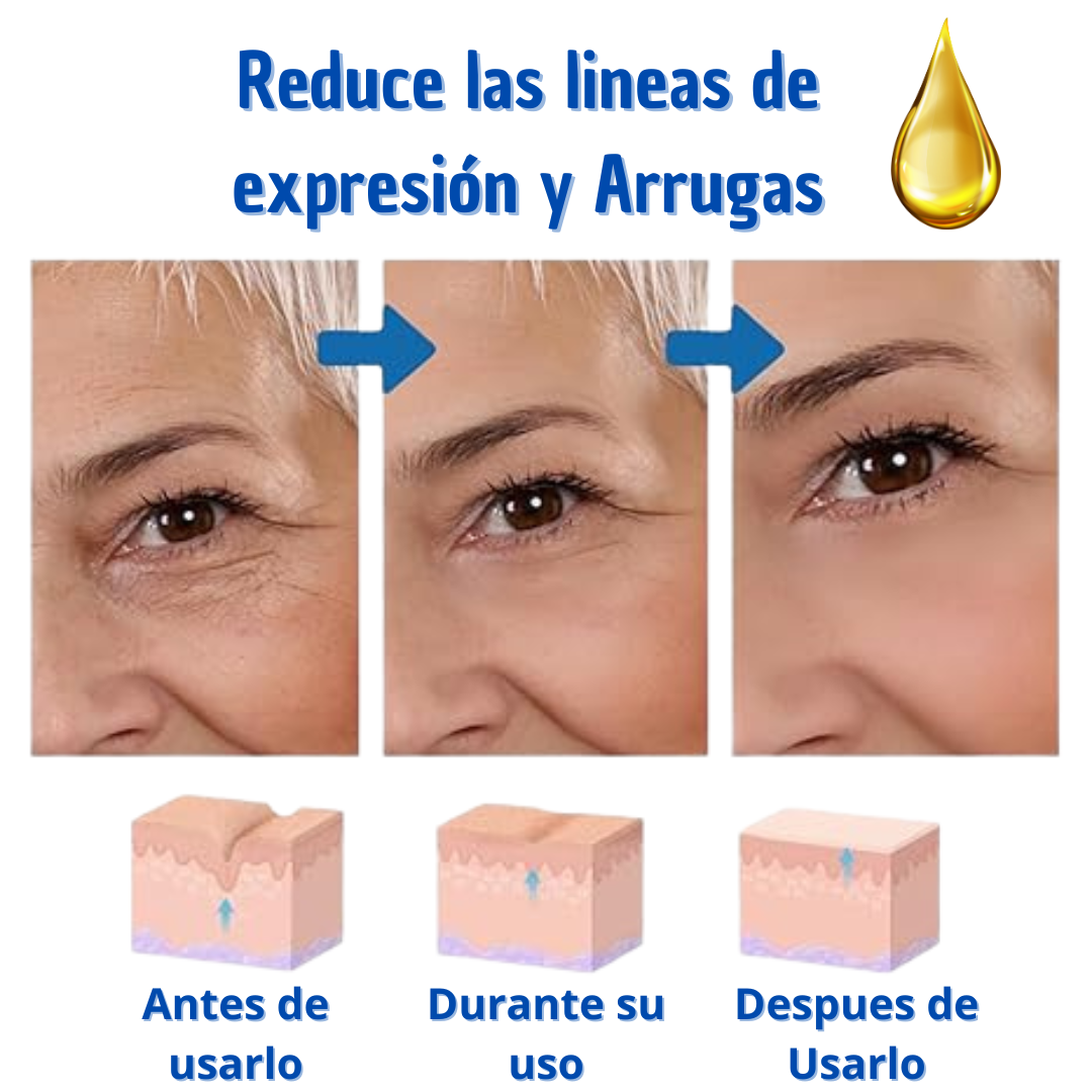 BOTOX SUERO ANTIEDAD