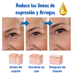 BOTOX SUERO ANTIEDAD