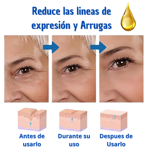 BOTOX SUERO ANTIEDAD